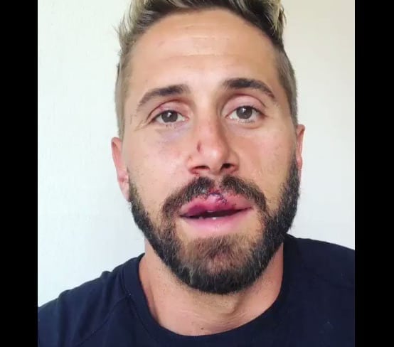 ‘you’re Not Always Safe In The Places You Think You Are’ Gay Porn Star Wesley Woods Assaulted