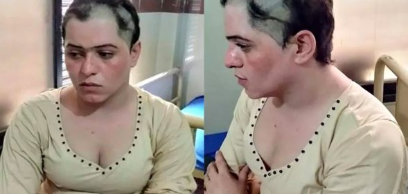 A Pakistani transgender woman with cropped hair and bald batches