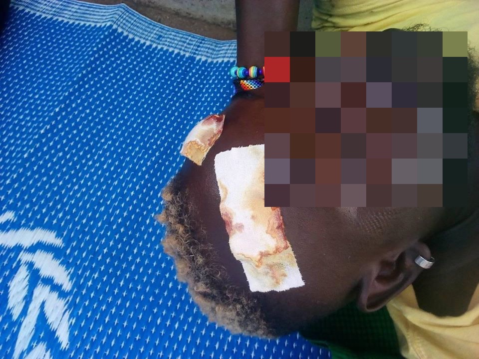 A trans man was brutally battered by a group of locals who entered the camp, a witness has claimed. (Facebook)