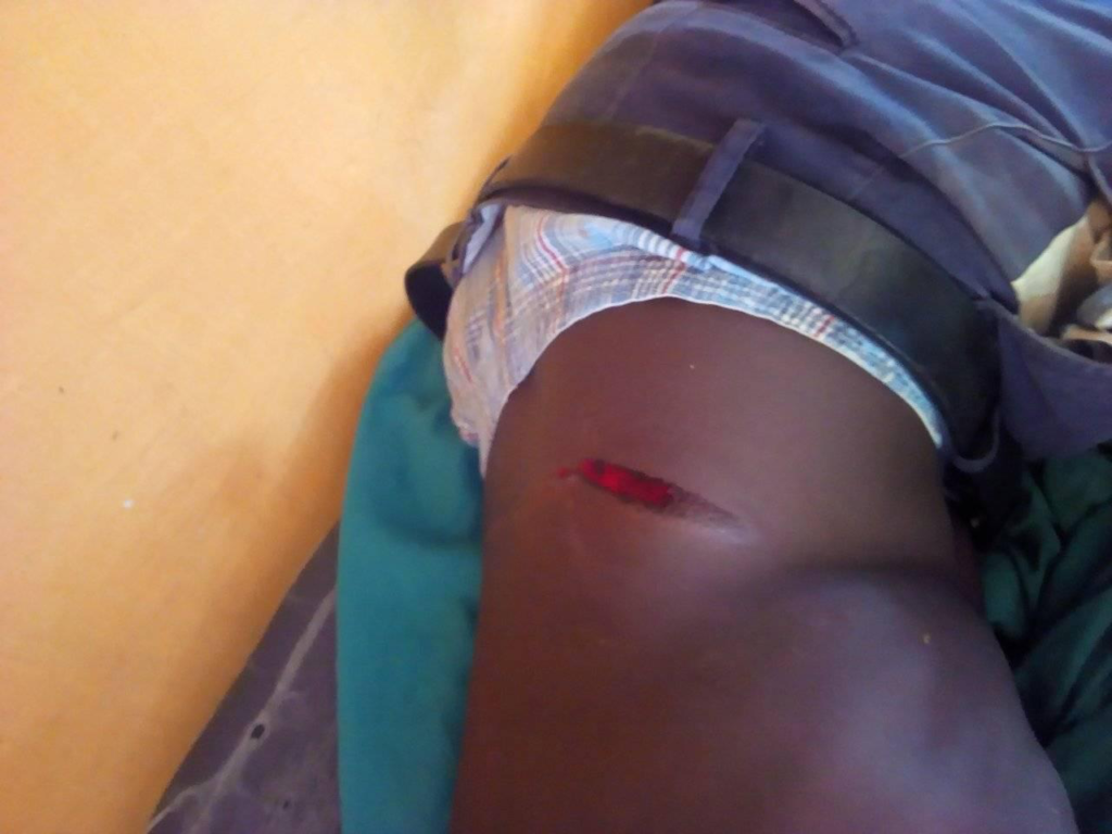 A trans protester was allegedly attacked by police, suffering a wound on his lower right torso as a result. (Supplied)