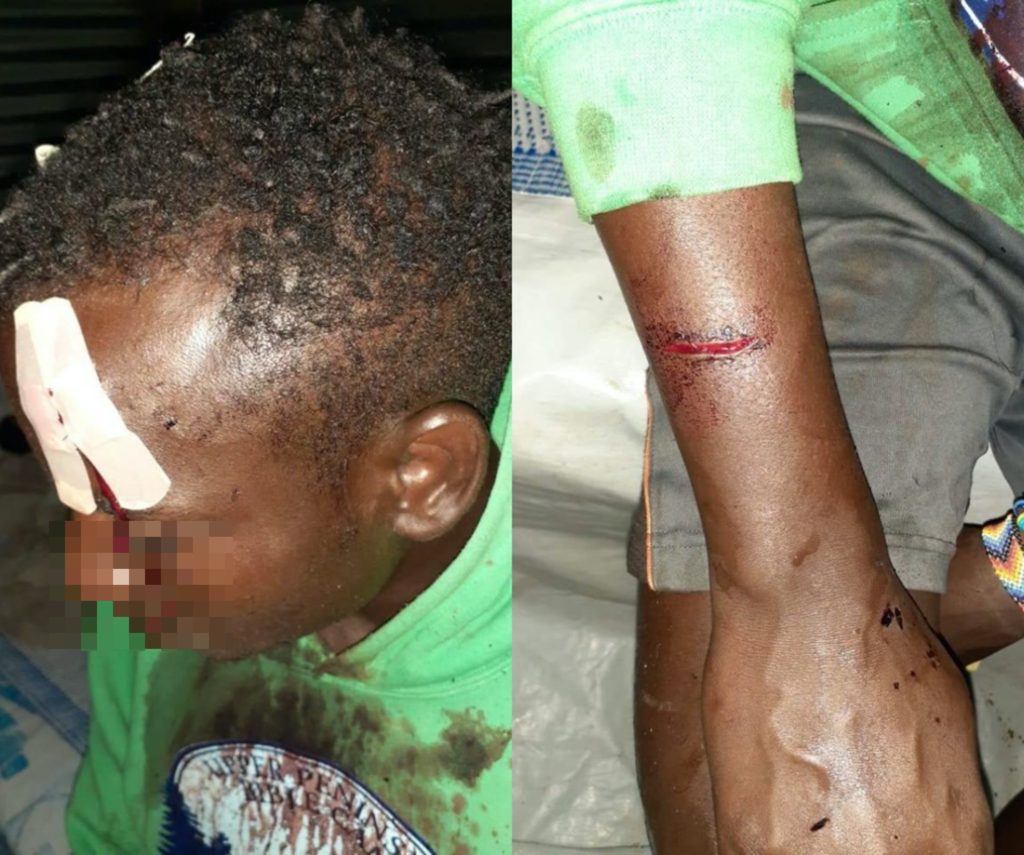 Stephen Sebuuma suffered cuts to her head and arm as a result of the attack. (Facebook)
