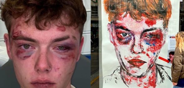 Josh Ormrod after he was attacked, and his portrait in Cardiff city centre