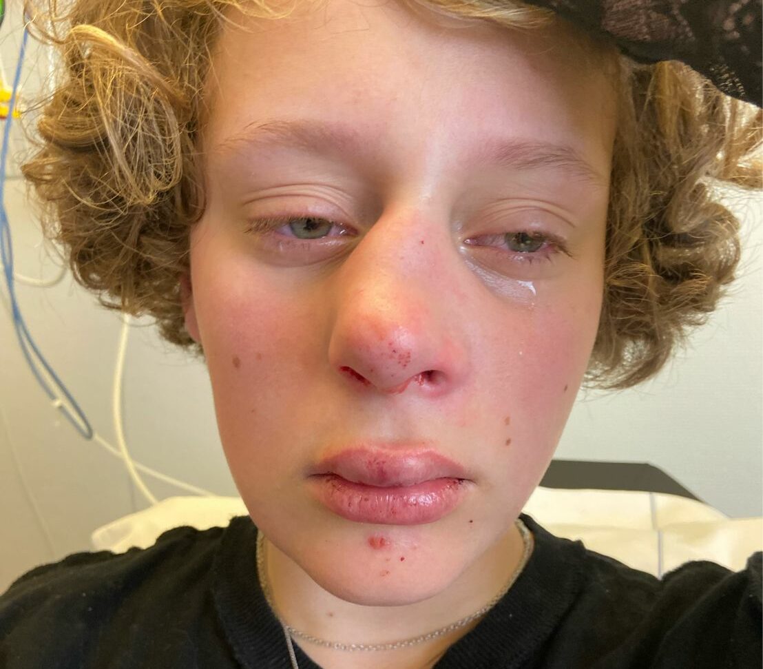 teen-left-with-broken-nose-and-fractured-jaw-for-refusing-to-answer