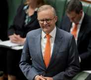 Prime minister Anthony Albanese confirmed a question about sexuality will be asked in Australia's 2026 census