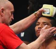 Jose Hernandez has vaseline applied to their face prior to the Super Featherweight fight between Jimmy Lee and Jose Hernandez at Wembley Arena on 26 March, 2022 in London, England.