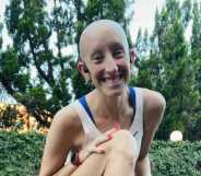 Lindsay Walter is a marathon runner who shares her experience of having alopecia.