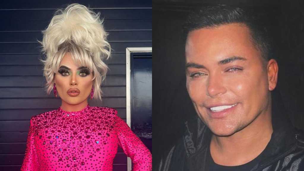 Baga Chipz after her hair surgery, in and out of drag.