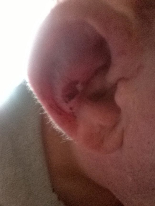 A hole can be seen in Andrew's ear (Andrew Williams-Coleman)