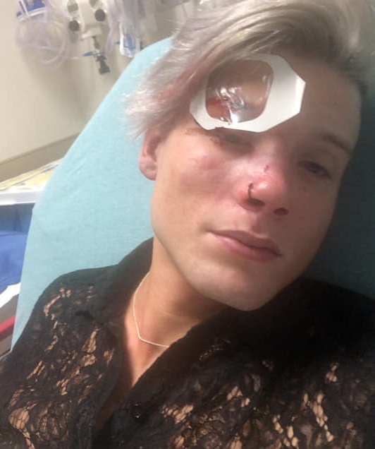 Texas gay couple attack: Tristan Perry was left with horrific injuries after being beaten and kicked in the head