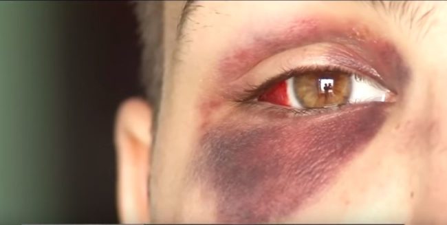 Transgender man assaulted in 'terrifying' hate crime in Colorado
